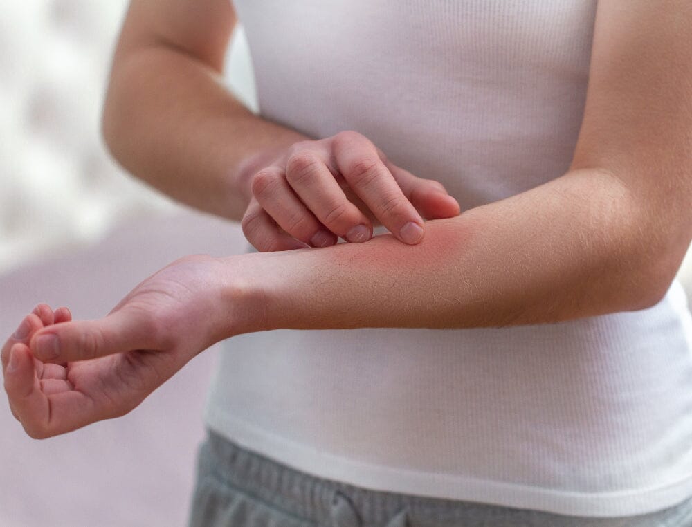 Eczéma comment choisir ma lessive pour ma peau sensible