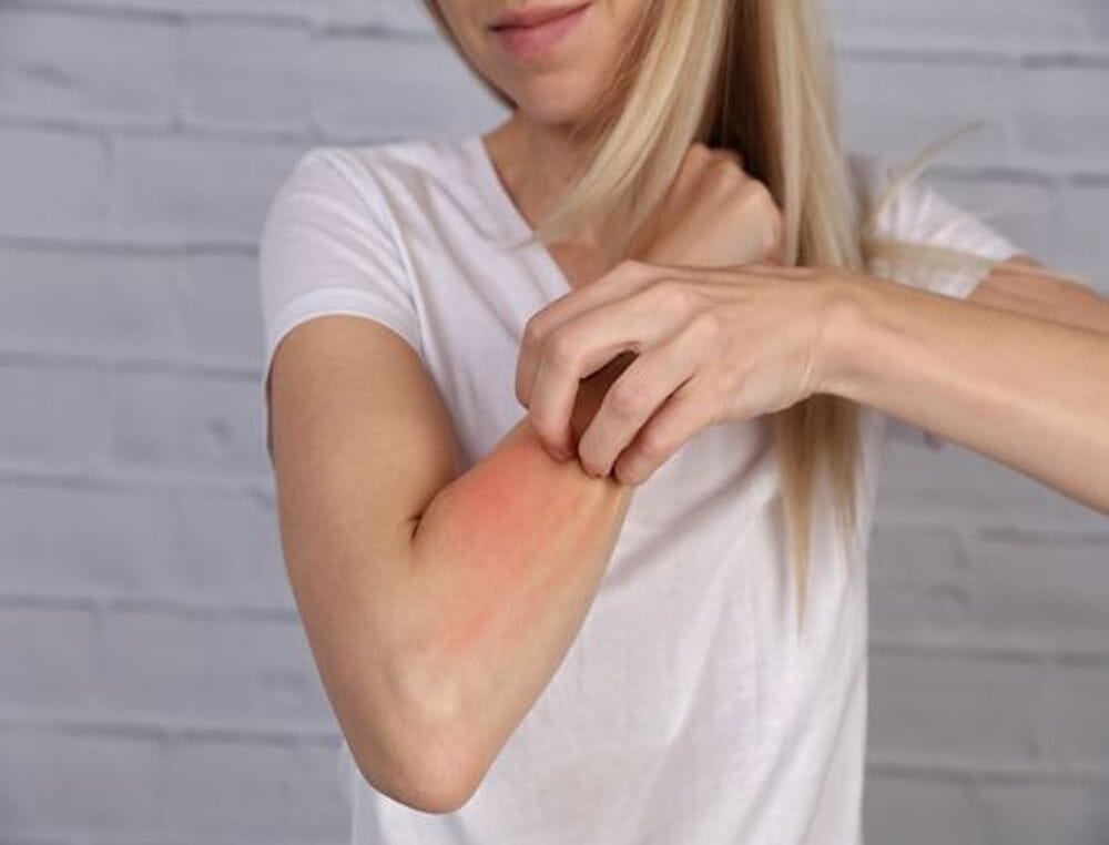 Quels sont les signes d’une allergie à la lessive ?